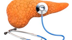 Pancreatitis